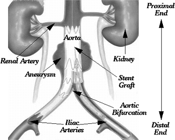 Anatomy of an AAA