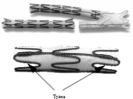 Anatomy of an AAA