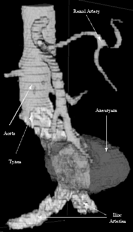 Anatomy of an AAA